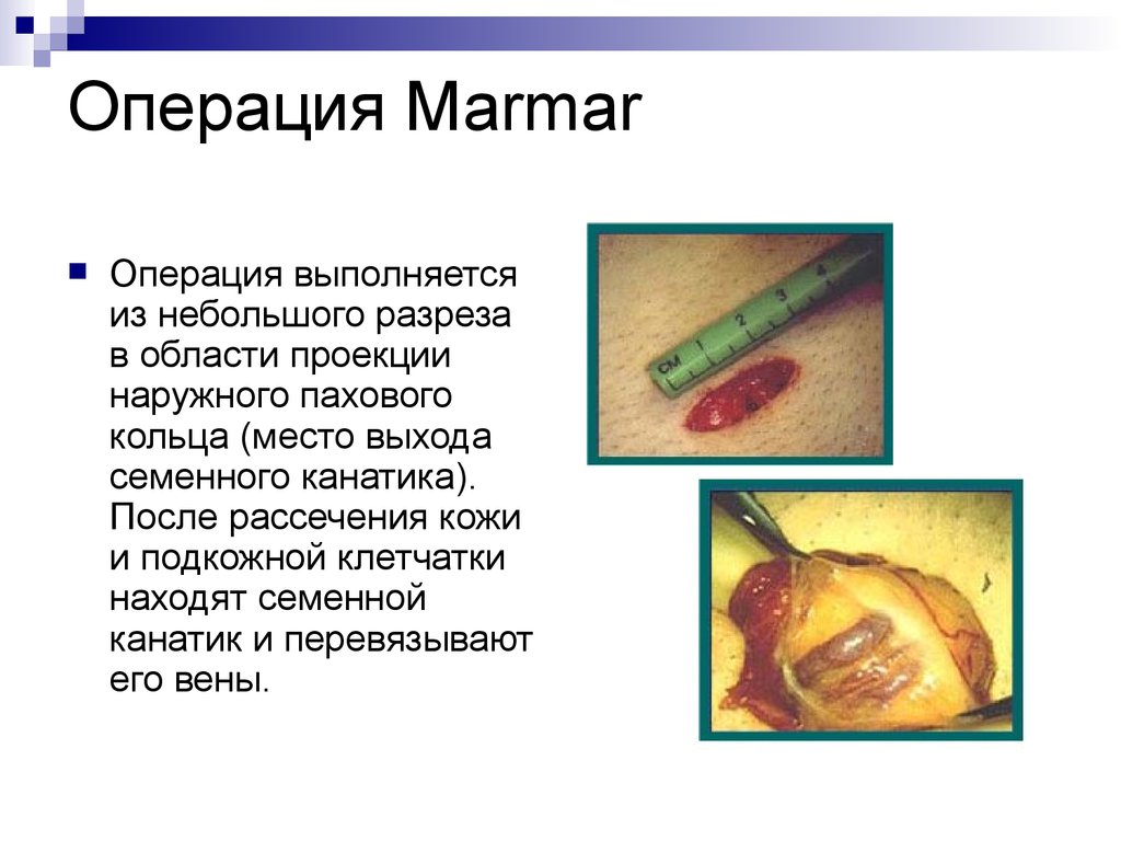 Операция Marmar