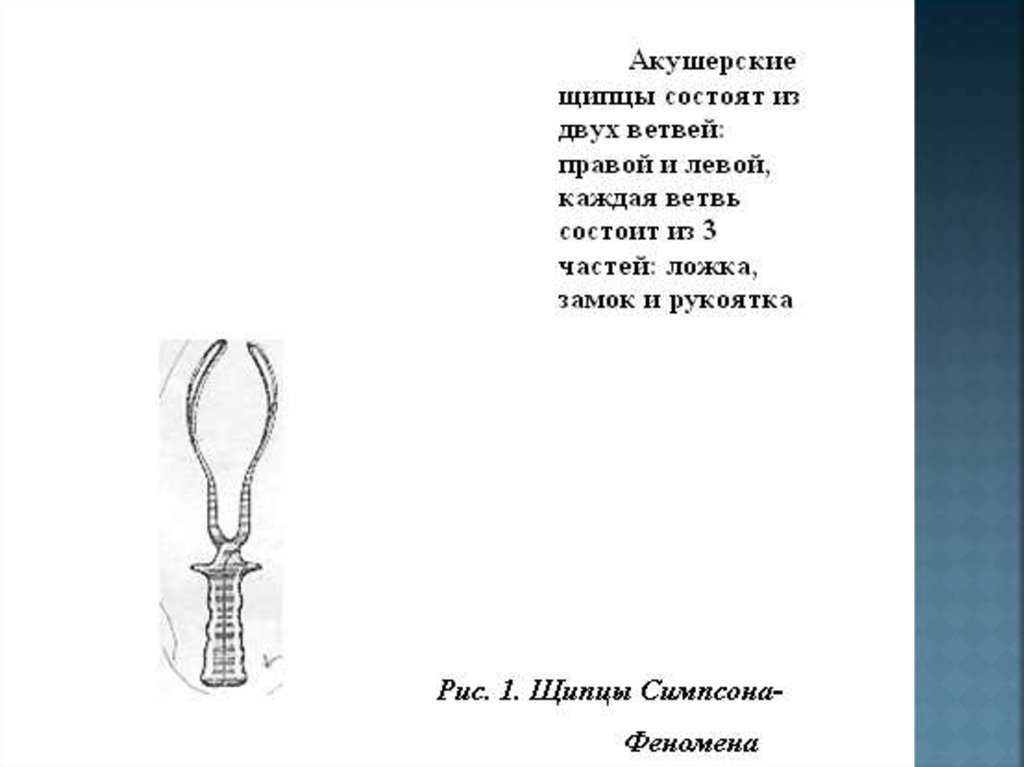 Презентация акушерские щипцы и вакуум экстракция плода