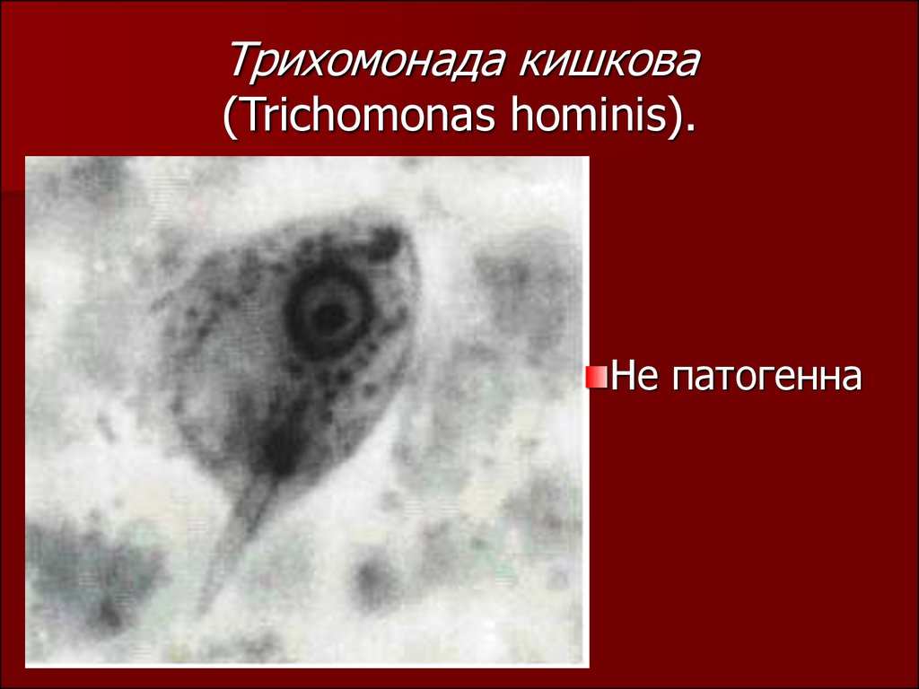 Трихомонада кишкова (Trichomonas hominis).