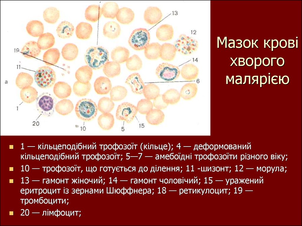 Морфология паразитических простейших. Простейшие паразиты человека. Простейшие паразиты растений. Вывод паразитические простейшие. Шизонт это