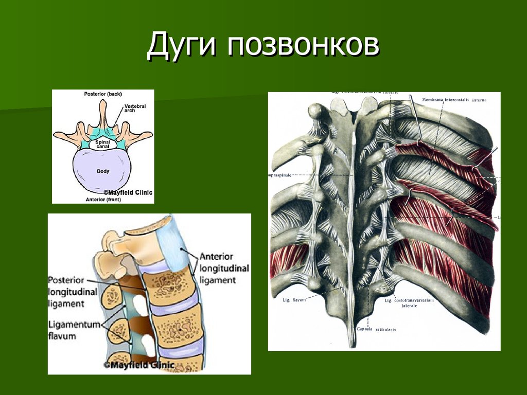 Дуга позвонка. Дуги позвонков. Строение позвонка дуга. Дуги позвонков анатомия.