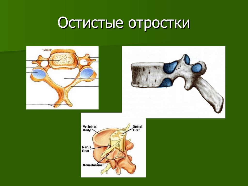 Остистые отростки позвоночника фото