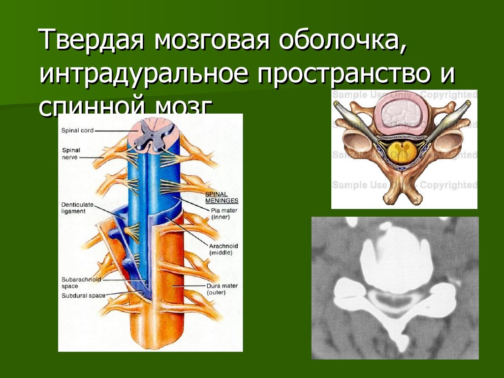 Твердо мозговая оболочка