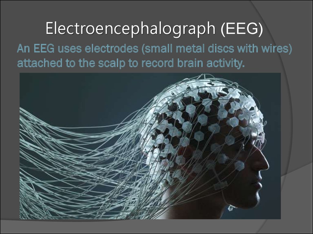 Encephalitis - Ð¿Ñ€ÐµÐ·ÐµÐ½Ñ‚Ð°Ñ†Ð¸Ñ  Ð¾Ð½Ð»Ð°Ð¹Ð½