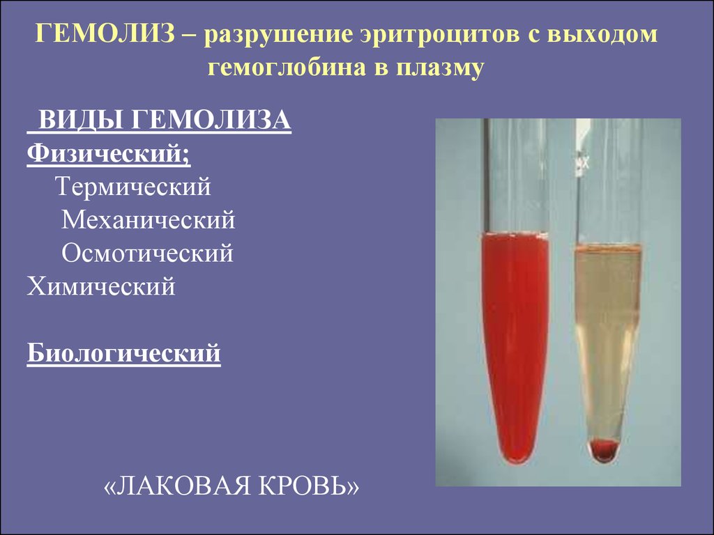 Гемолиз что это простыми. Признак гемолизированной крови плазма. Гемолиз эритроцитов в пробирке. Причины осмотического гемолиза эритроцитов. Гемолиз эритроцитов лаковая кровь.