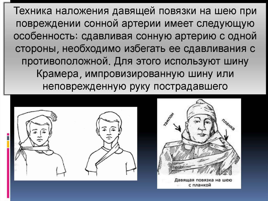 Наложение повязки на шею. При ранении сонной артерии. Наложение давящей повязки на сонную артерию. При ранении сонной артерии необходимо.