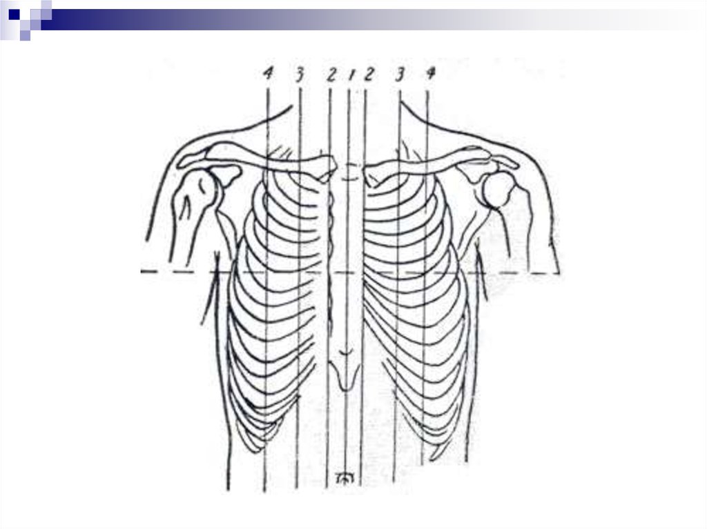 Линии ребер. Топография линии грудной клетки. Топографические линии грудной клетки. Топографические линии грудной клетки схема. Топографическая анатомия грудной клетки линии.