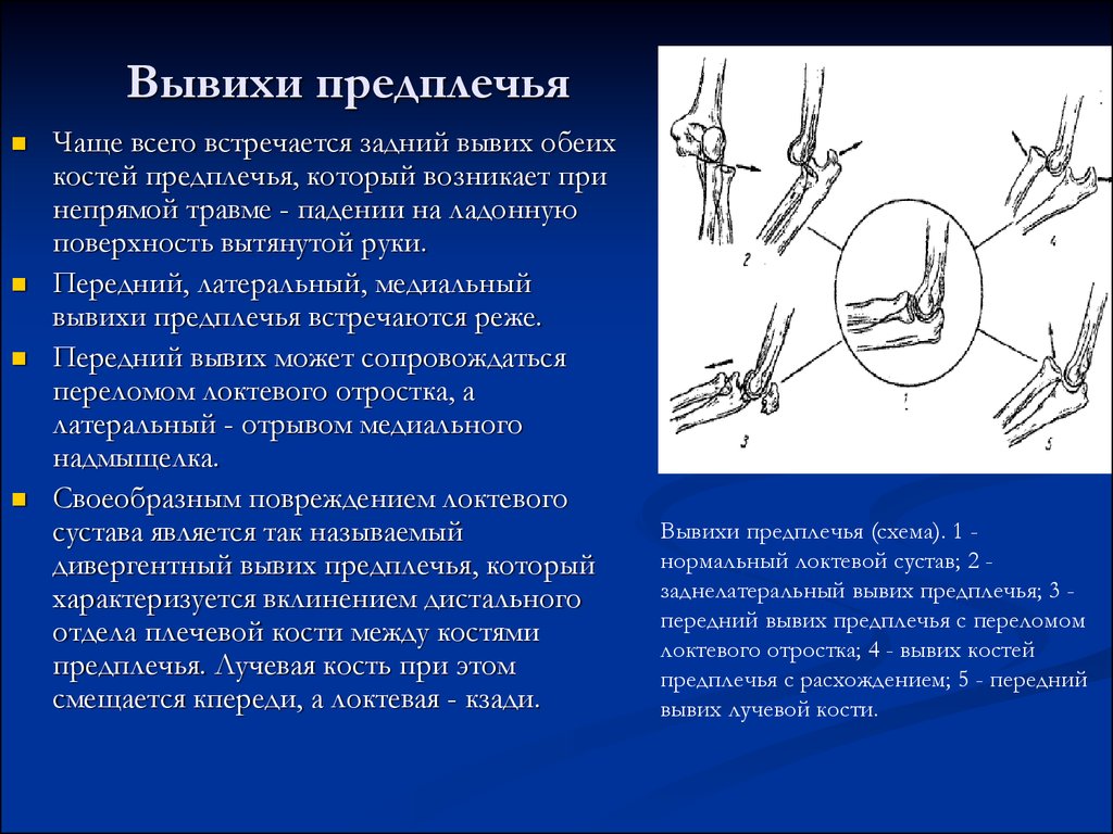 Вывих левого локтевого сустава карта вызова