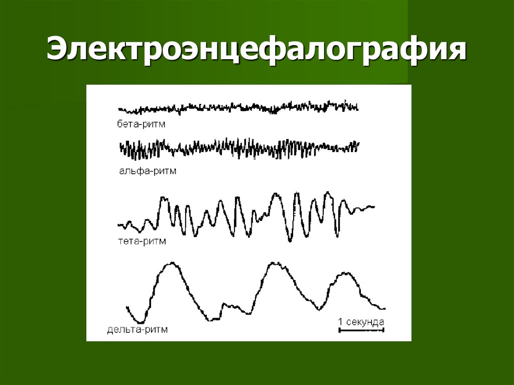 Ритмы энцефалограммы