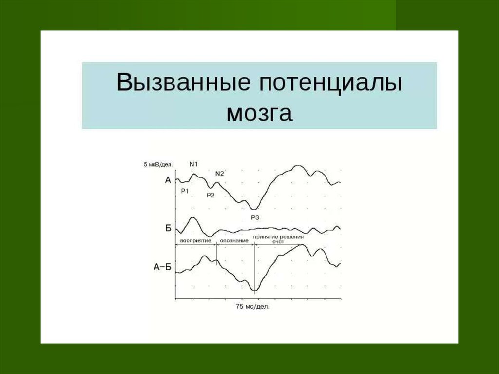 Зрительные вызванные потенциалы