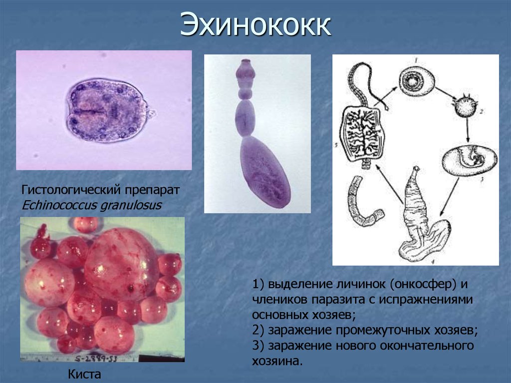 Признаки характерные для эхинококка в живом организме. Финна эхинококка паразитирует в -. Эхинококк Финна цистицерк.