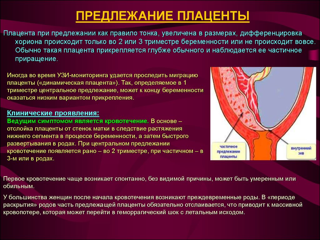 Help! предлежание плаценты. Беременность и роды