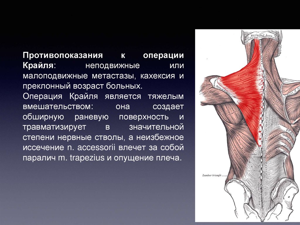 Комбинированные повреждения чло презентация