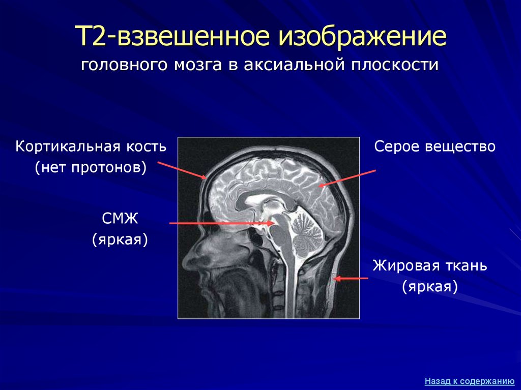 Взвешенное изображение мрт что это