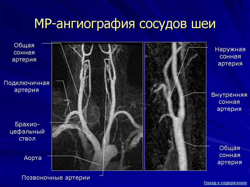 Методы контрастирования изображения