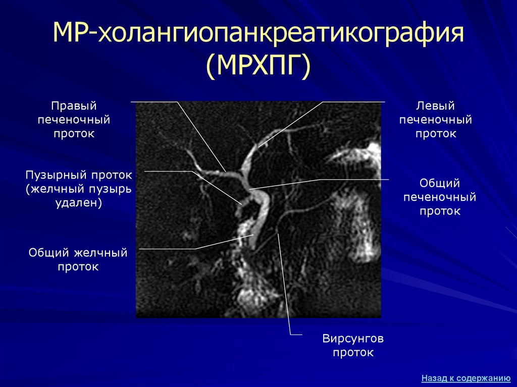 Магнитно резонансная томография презентация