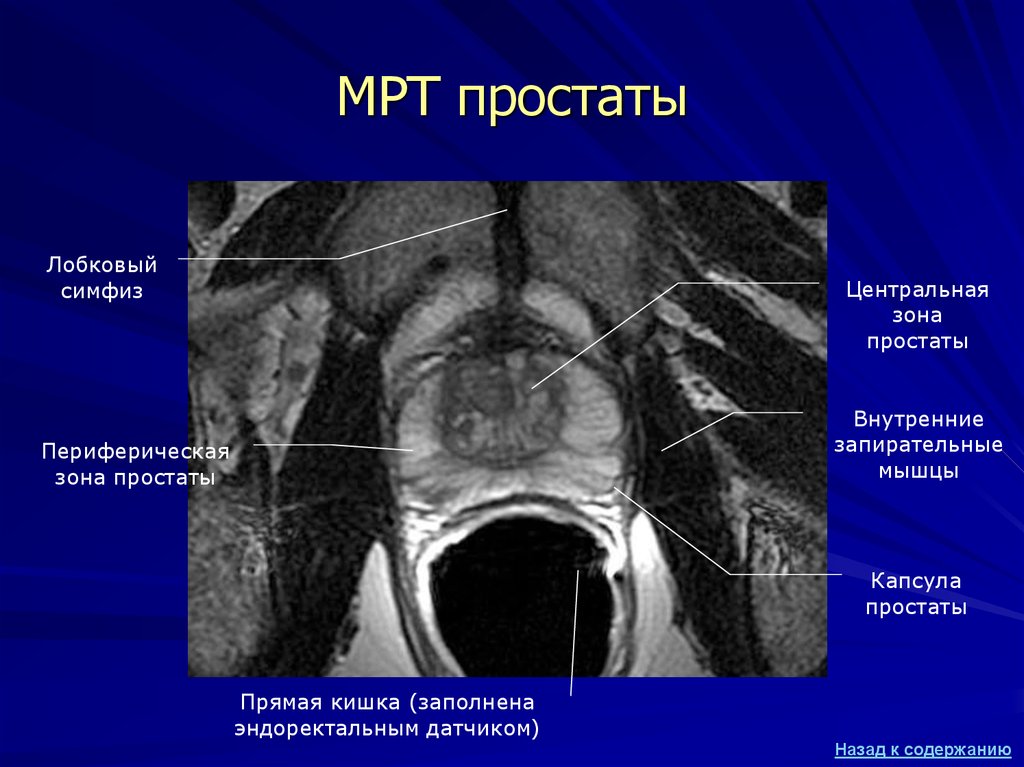 Зона простаты у мужчин фото