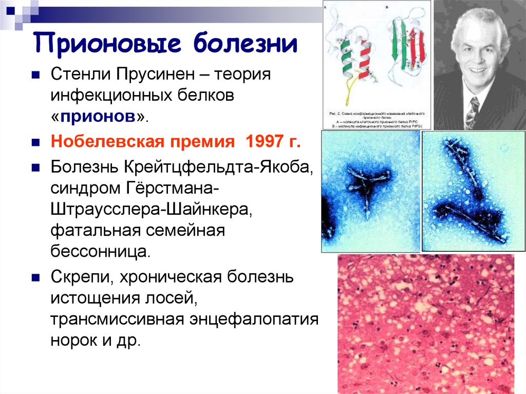 Прионные инфекции