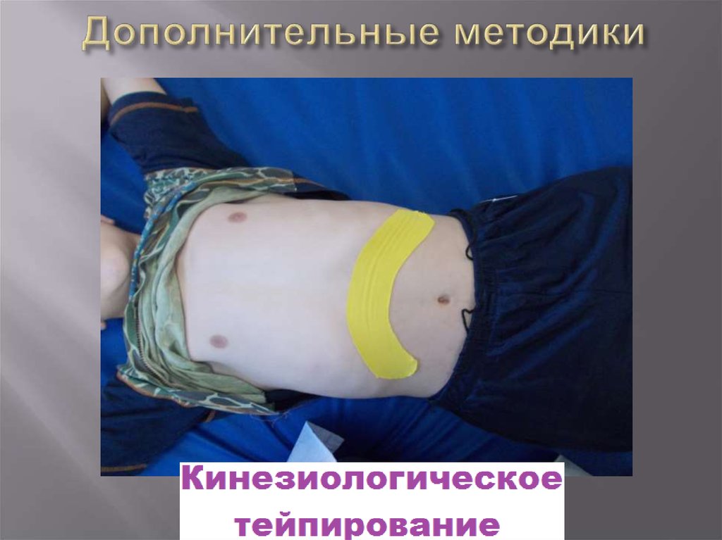 Дополнительные методики