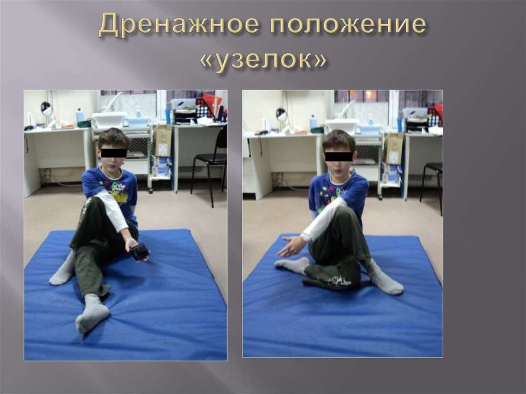 Дренажное положение «узелок»