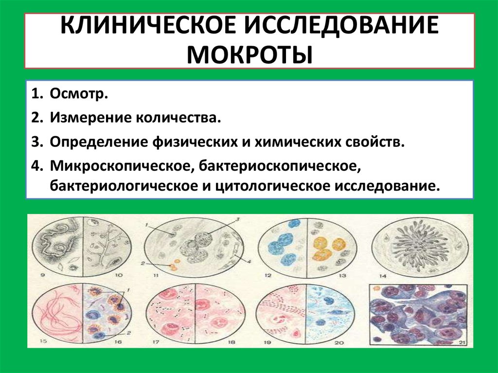 Цитологическое исследование мокроты в Санкт-Петербурге