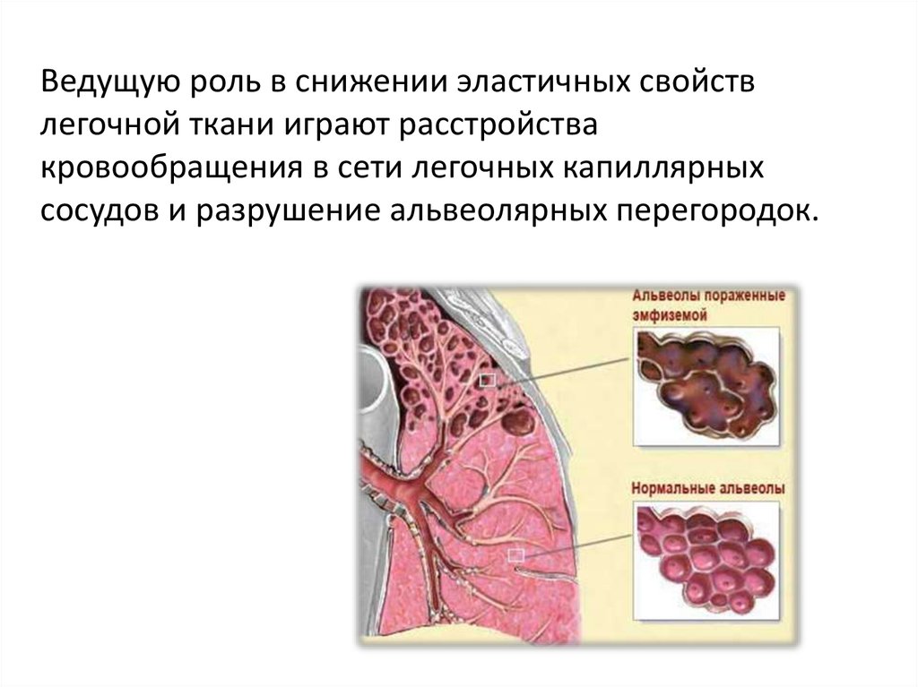 Легочная ткань. Ухудшением эластичности легочной ткани. Эластичность легочной ткани. Показатели эластичности легочной ткани. Изменением эластических свойств легочной ткани.