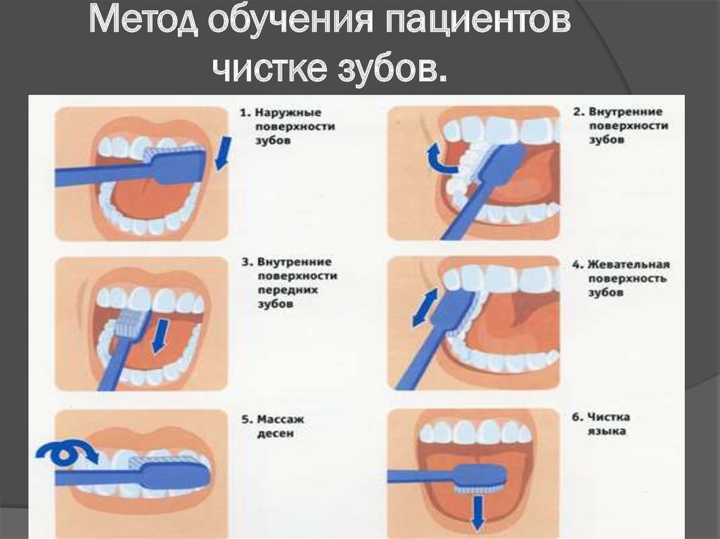 Метод басса чистка. Правильная методика чистки зубов зубной щёткой. Методы чистки зубов стандартный метод. Стандартный метод чистки зубов схема. Методы чистки зубов: стандартный метод чистки.