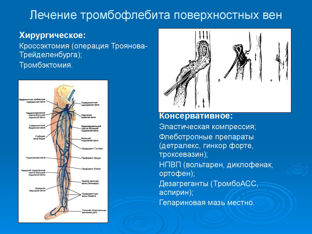 Тромбоз глубокой вены нижней конечности. Тромбоз поверхностный вен верхней конечности конечности. Восходящий тромбофлебит большой подкожной вены. Тромбоз поверхностных вен нижних конечностей. Диагностика тромбоза глубоких вен верхней конечности.