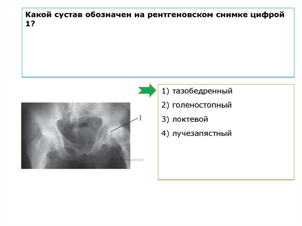 Какой цифрой на рисунке обозначена суставная полость