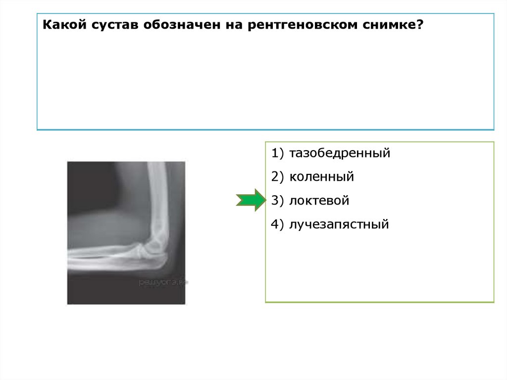 Какой цифрой на рисунке обозначена суставная полость