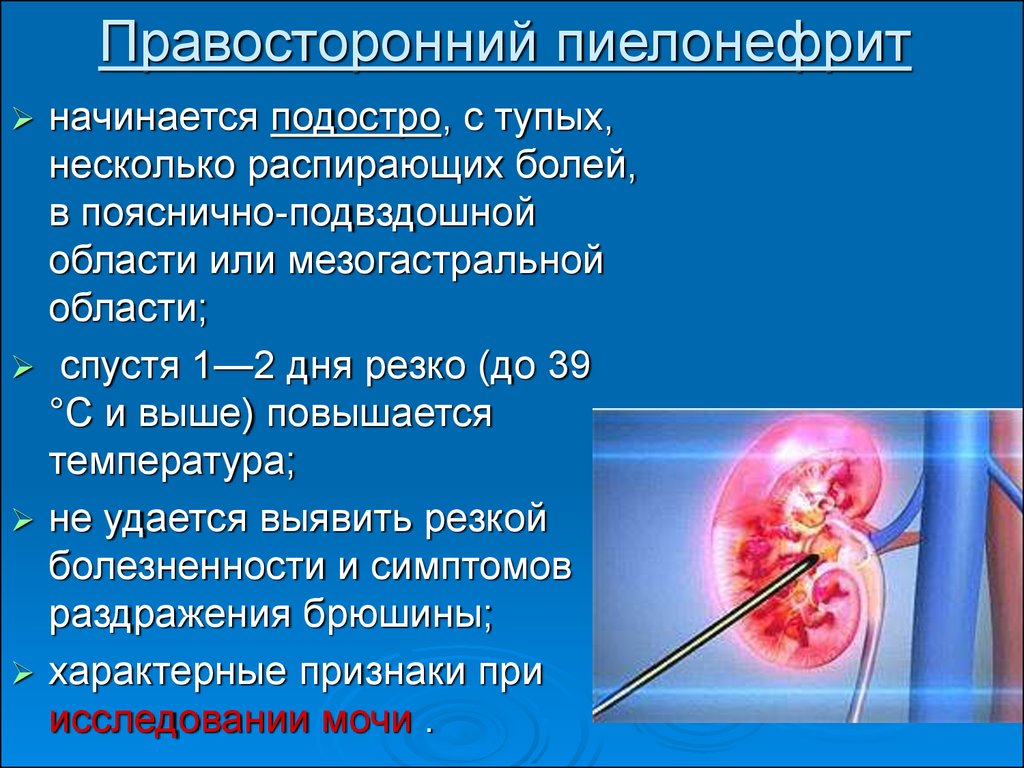 Распирающая боль. Правосторонний пиелонефрит. Острый правосторонний пиелонефрит. Острый пиелонефрит локализация. Правосторонний пиелонефрит диагноз.