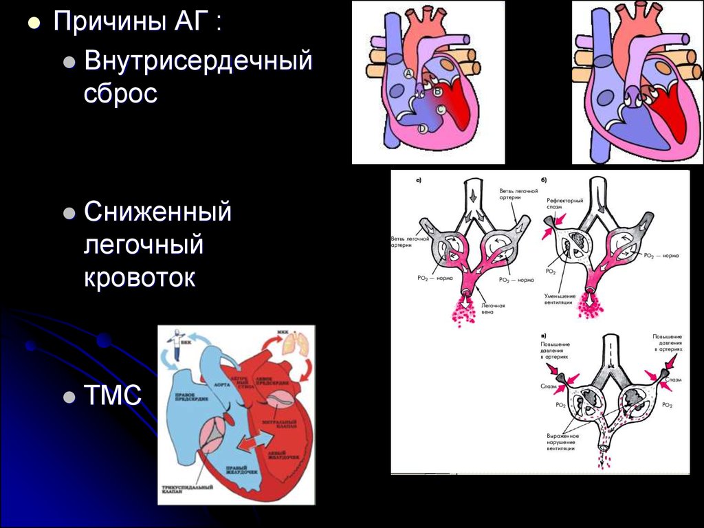 Врожденные пороки с цианозом