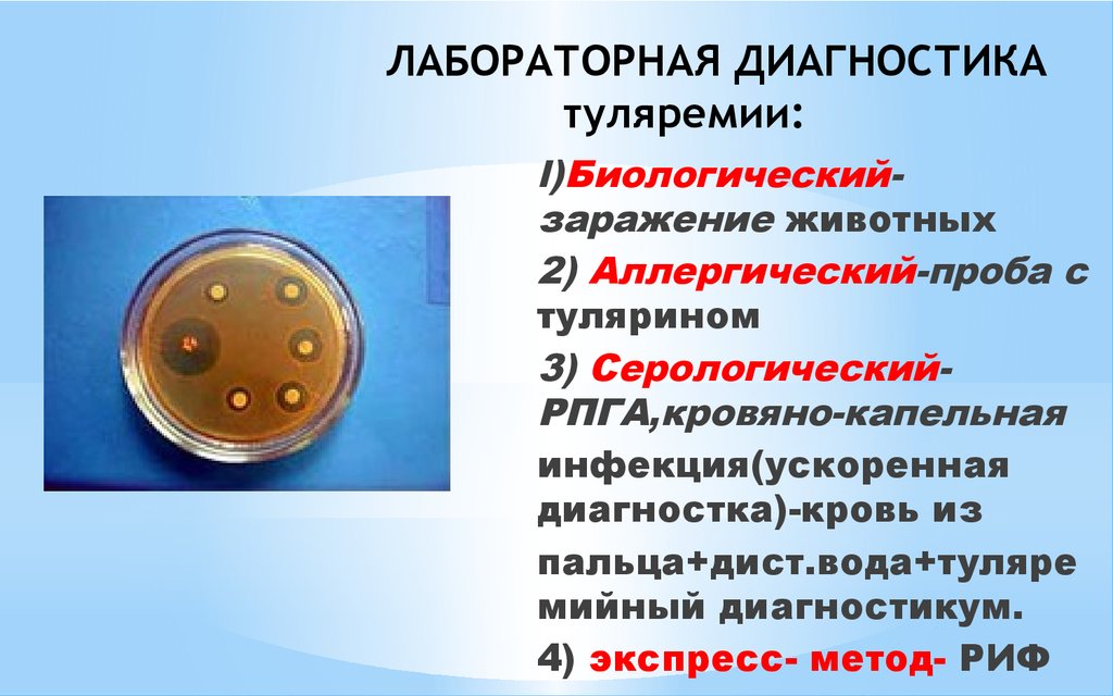 План обследования при туляремии