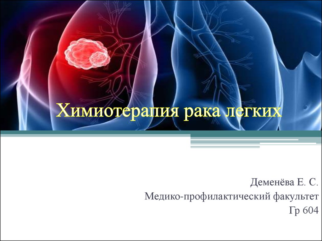 Пхт в онкологии. Химия терапия при легких. Химиотерапия легких. Химиотерапия в онкологии презентация.