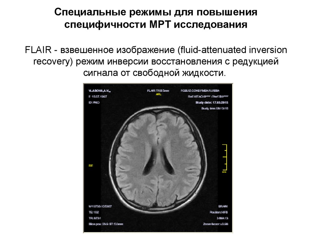 Режимы мрт презентация