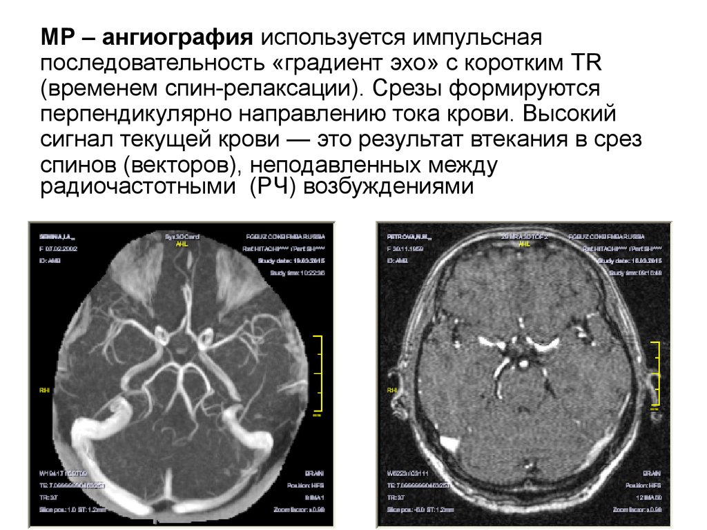 Где сделать кт ангиографию