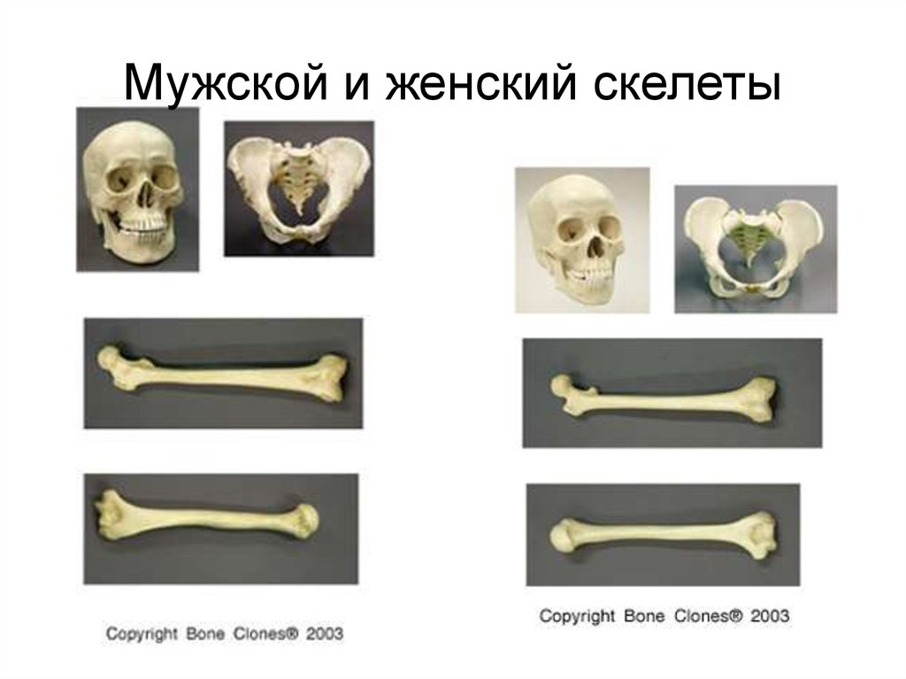 Отличить кость