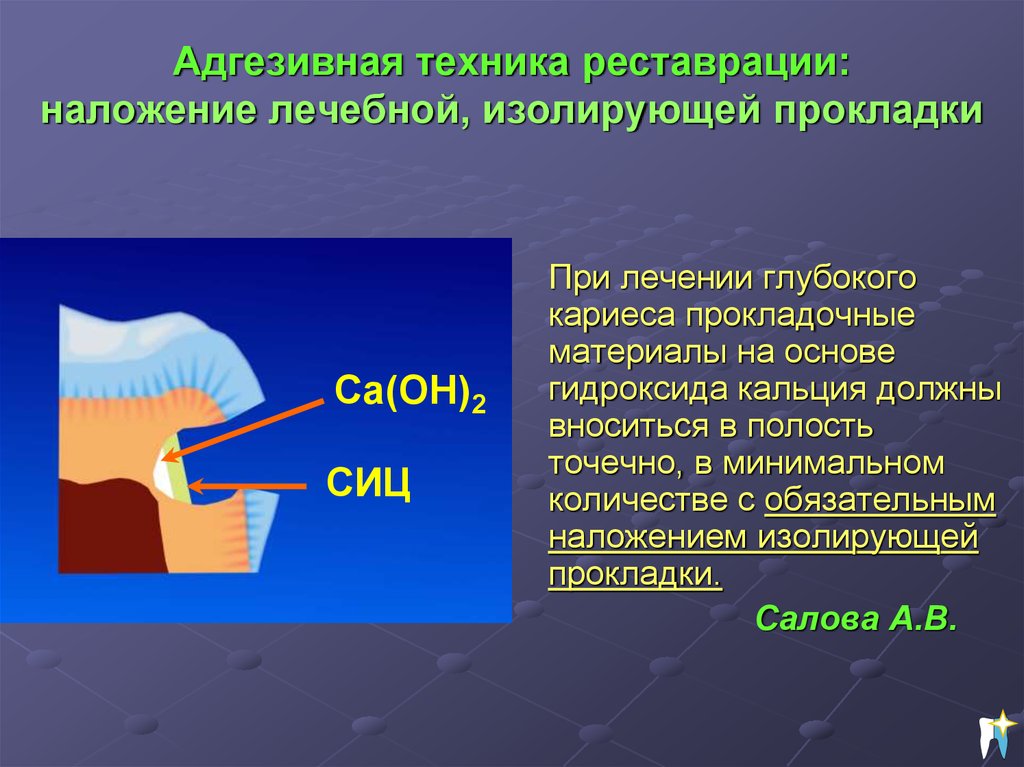 Лечение глубокого. Лечебная и изолирующая прокладка. Адгезивная техника пломбирования. Наложение изолирующей прокладки адгезивная техника.