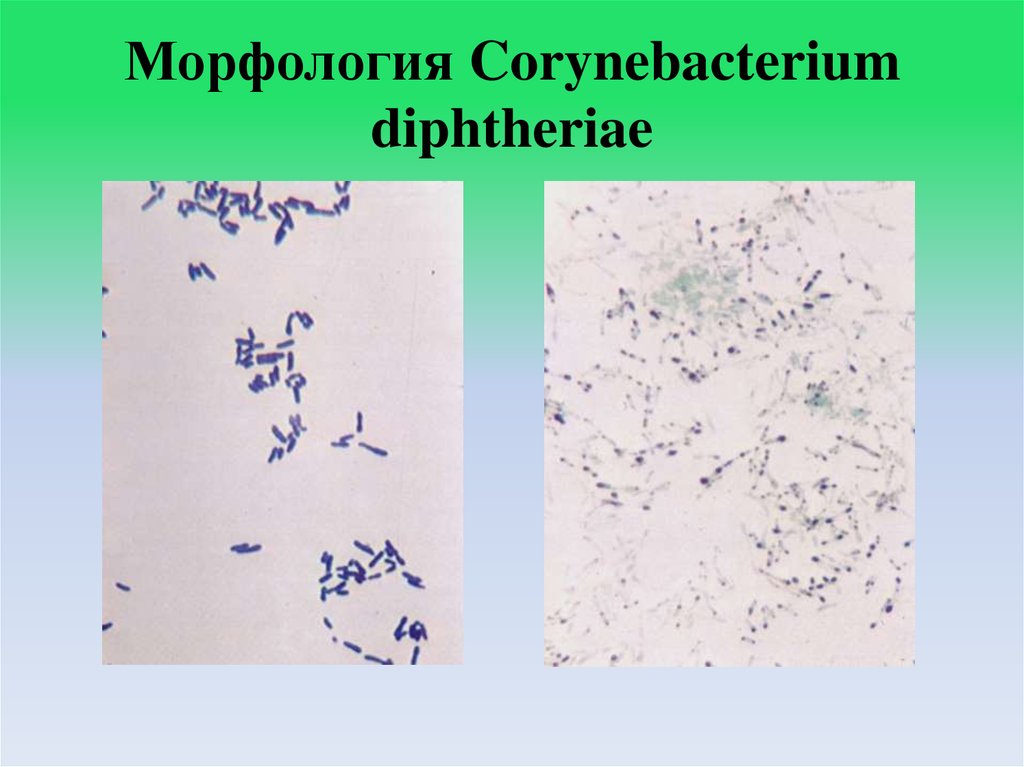 Возбудителя дифтерия возможна. Марфология corynevacterium diphheriae. Corynebacterium diphtheriae морфология. Возбудитель дифтерии окраска по Граму. Морфология возбудителя дифтерии.