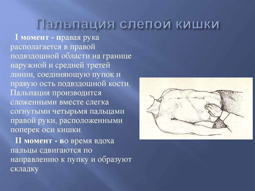 4 нарисовать топографическое расположение отделов толстого кишечника при глубокой пальпации живота