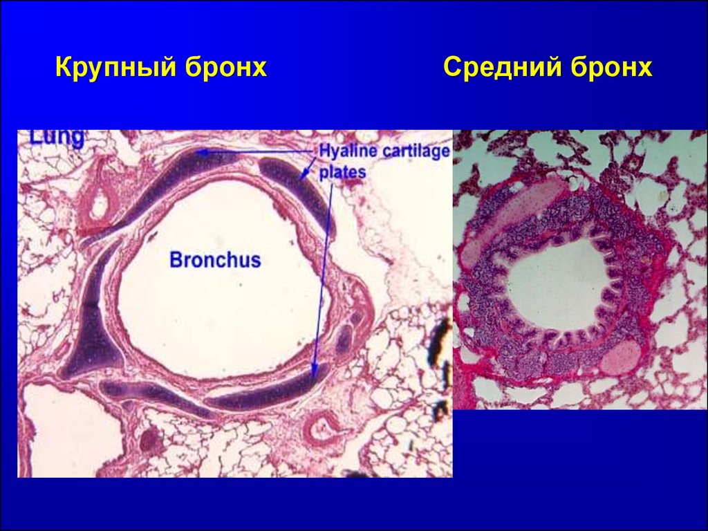 Оболочки бронхов. Бронх крупного калибра гистология. Бронхи среднего калибра гистология. Бронх среднего калибра гистология. Стенка бронха среднего калибра гистология.