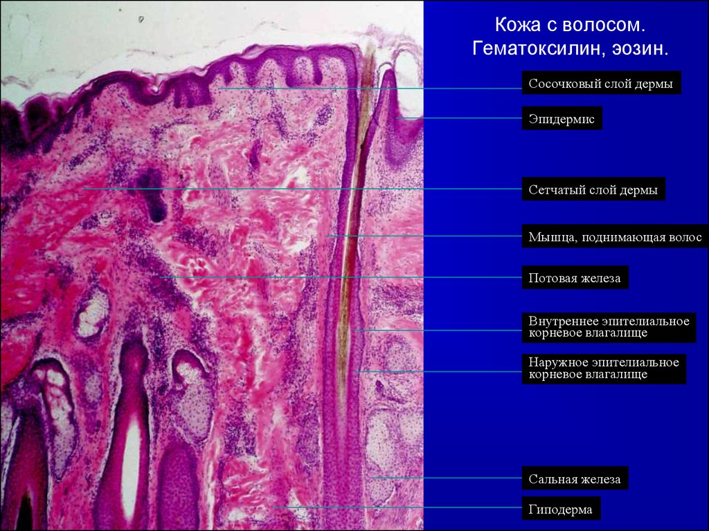 Срез кожи с волосом гистология рисунок