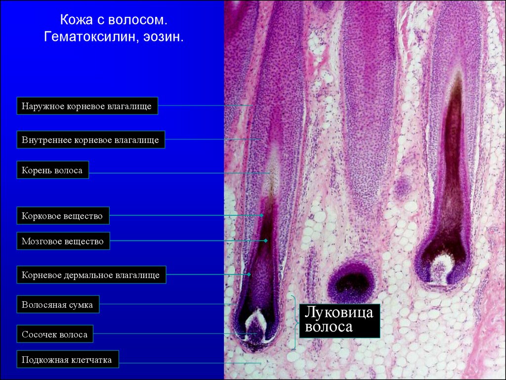 Кожа с волосом. Кожа волосистой части головы гистология препарат. Тонкая кожа гистология препарат. Волос гистология препарат.