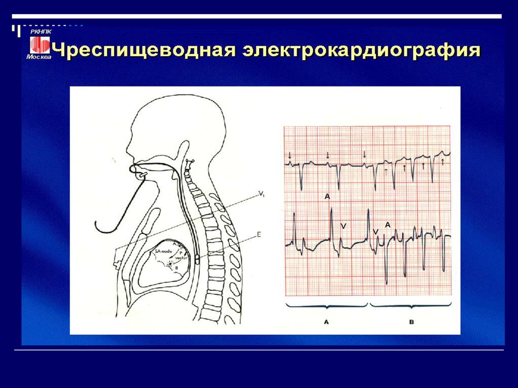 Методы обследования в кардиологии презентация