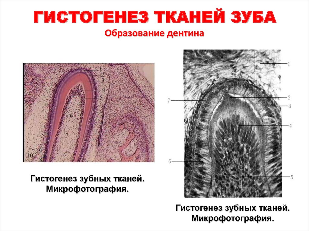 Гистология зуба презентация