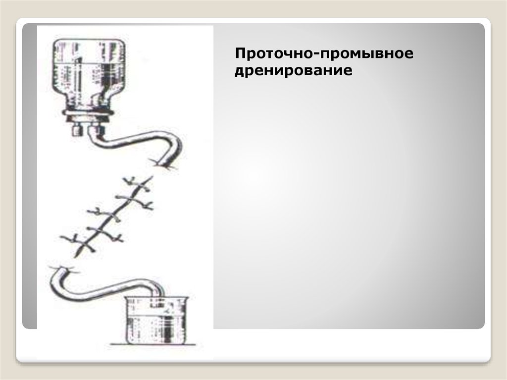 Дренирование ран презентация