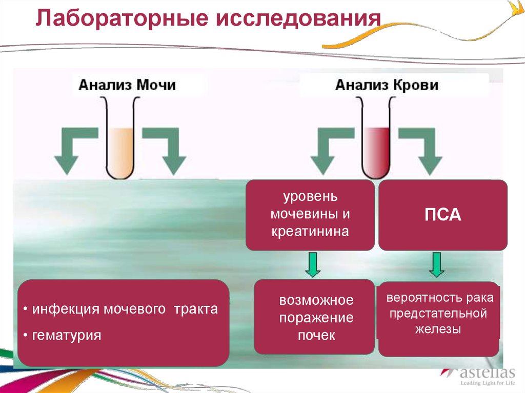 Гиперактивный мочевой пузырь презентация