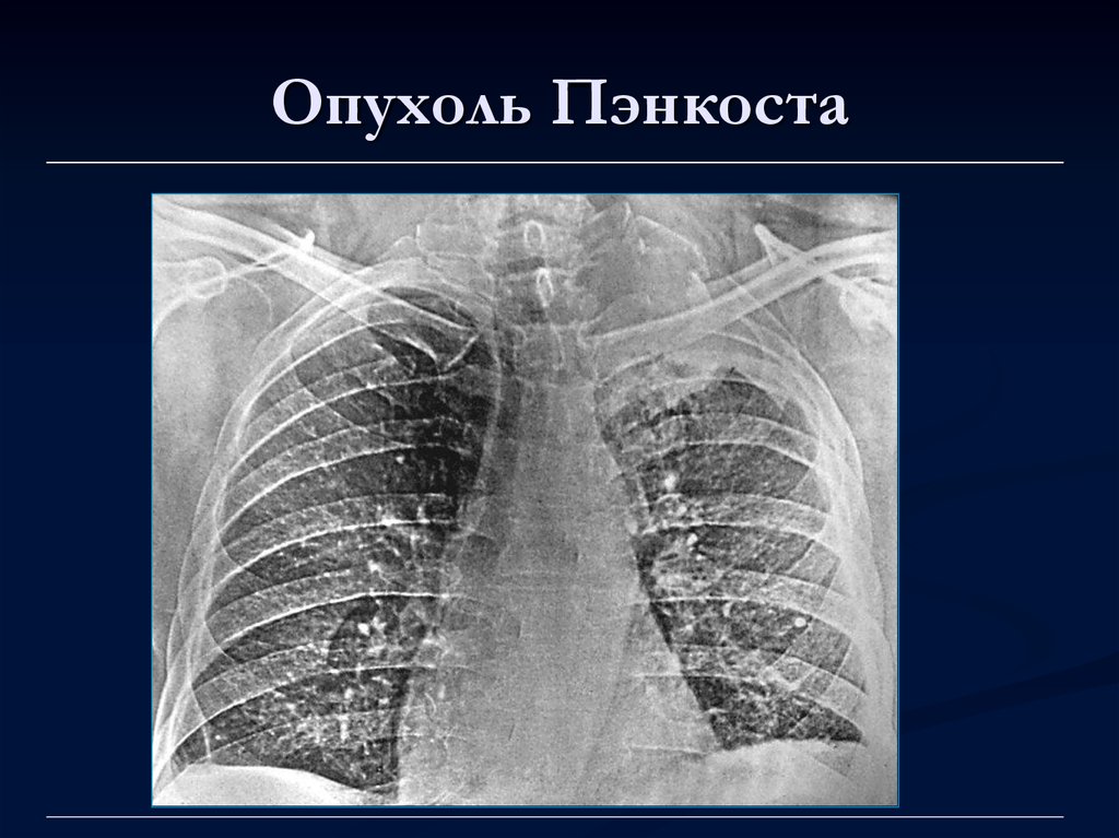 Лучевая диагностика органов дыхания презентация