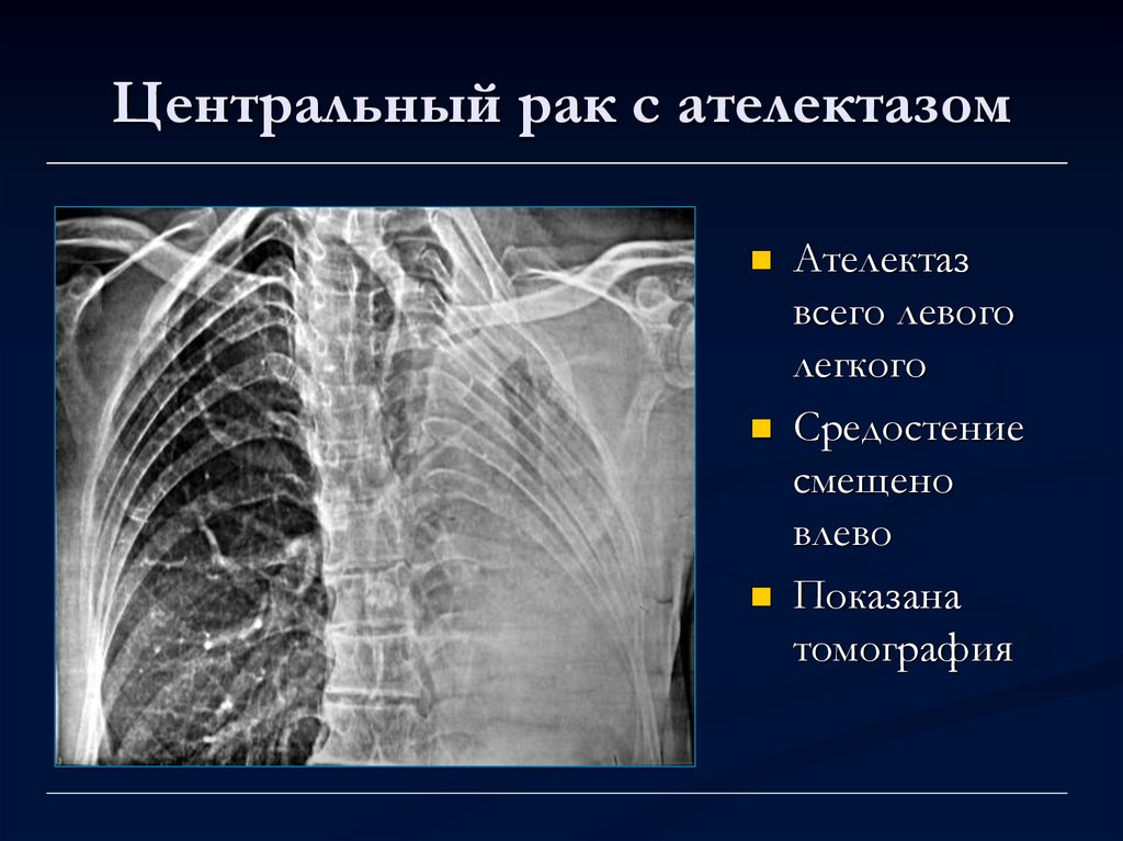 Лучевая диагностика средостения презентация