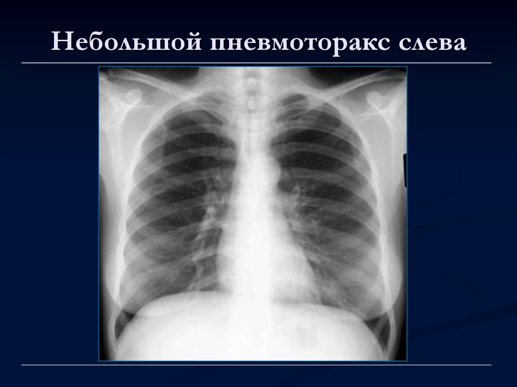 Лучевая диагностика органов средостения презентация